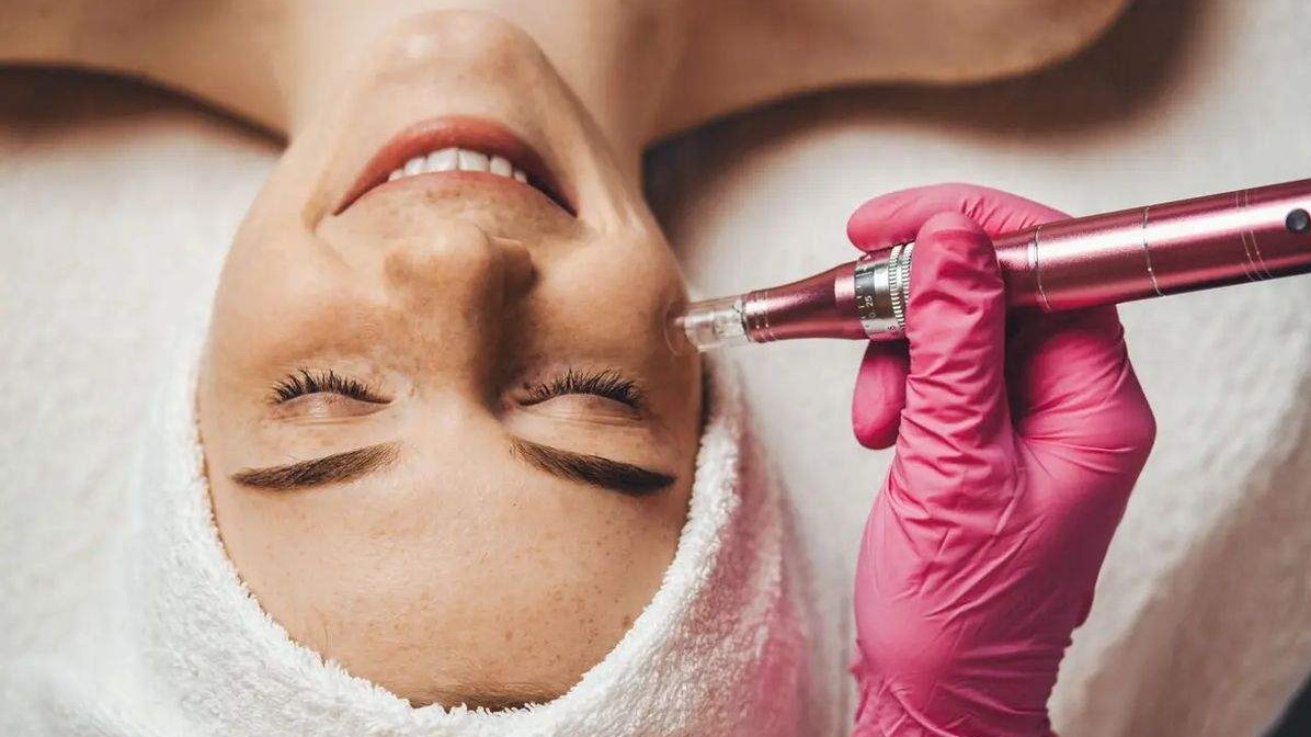 Microneedling